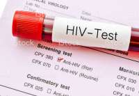 Testiranje i savetovanje na HIV biće organizovano u subotu, 1. decembra, u periodu od 8 do 12 časova i od 3. do 7. decembra u periodu od 10 do 12 časova