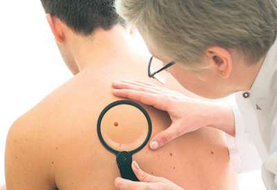 Prijavite se i Vi i saznajte koliki je Vaš rizik za nastanak raka kože i zakažite pregled kod dermatologa 8. maja